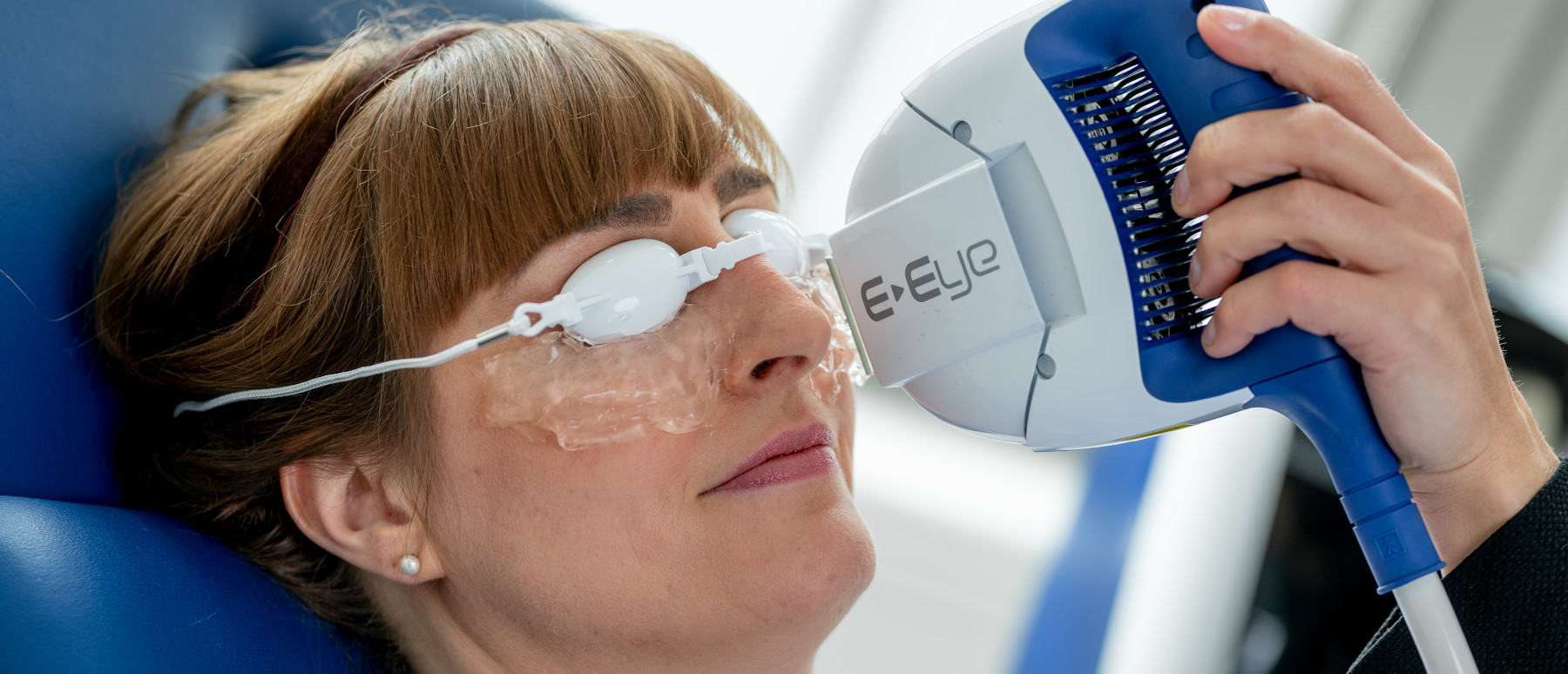 Eine Frau lässt ihre trockenen Augen mit e-eye bei den Augenpartnern behandeln