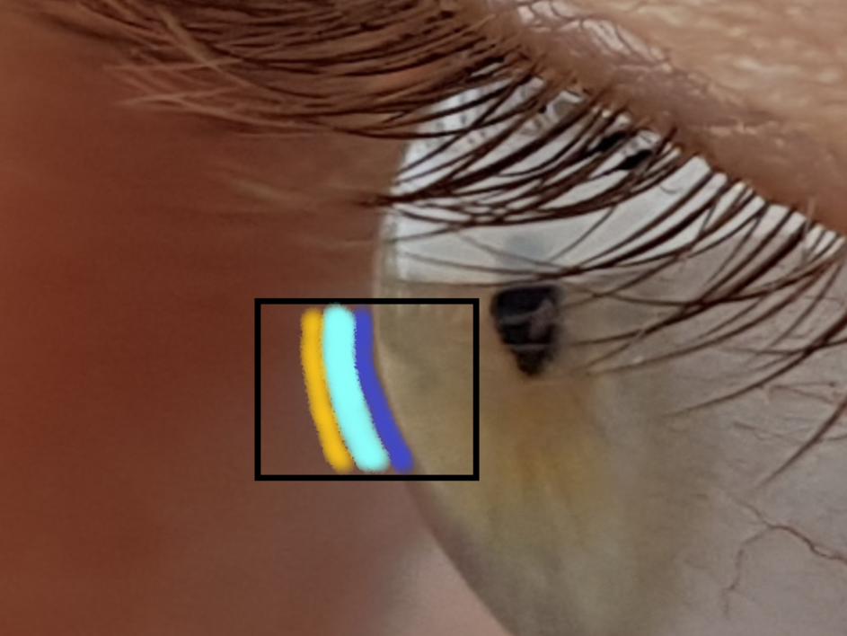 Lipidschicht des Auges